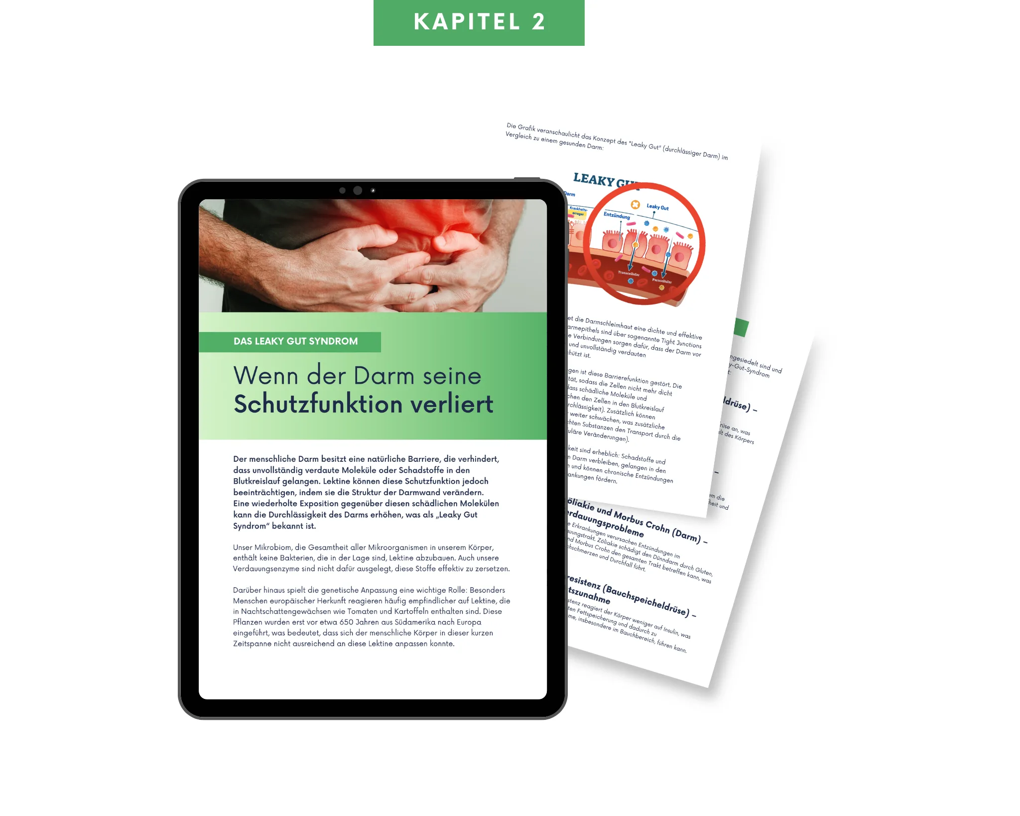 Kapitel 2 Das Leaky-Gut-Syndrom
